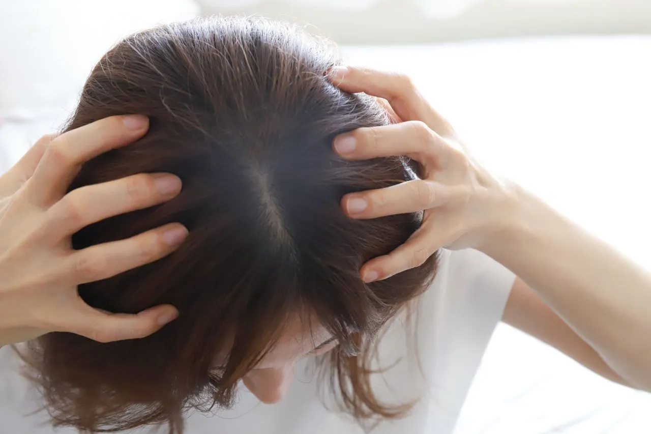 髪の分け目が目立つ！原因と対策方法は？