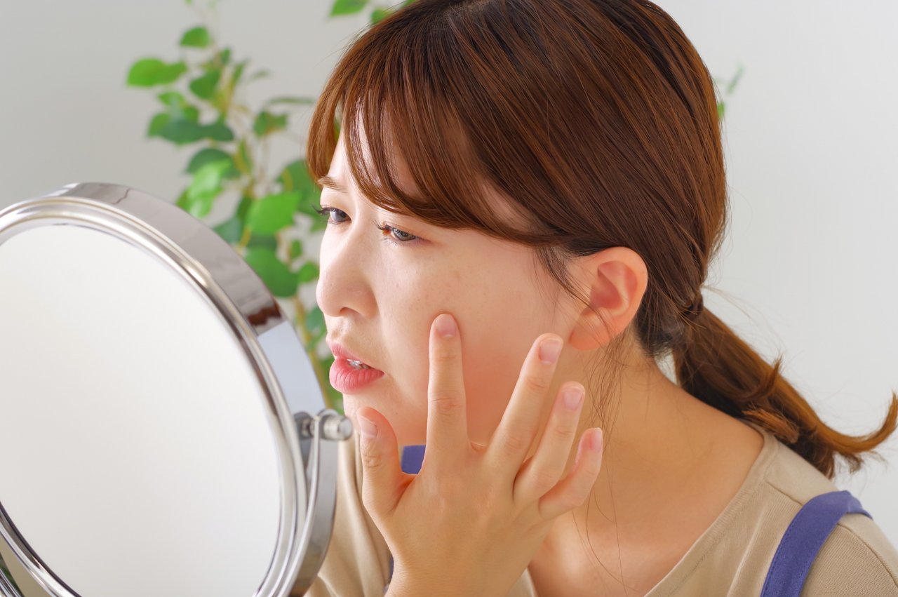 そばかすは消すことができる？消すor薄くする方法について